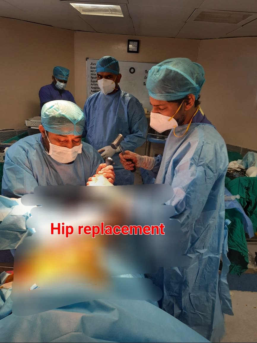 Hip Replacement